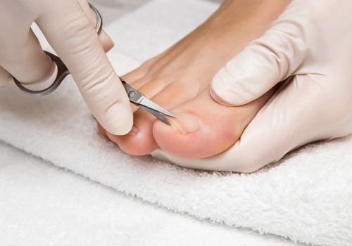 Классический педикюр